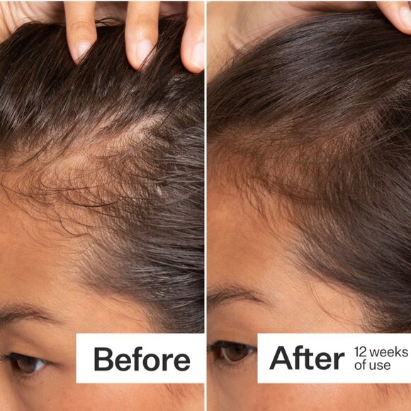 ACT + ACRE Cold Processed®Stem Cell Scalp Serum 30ML $65 - Picture 4 of 9